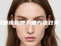 双眼皮松弛下垂方法效果怎样_双眼皮松弛下垂才有好的效果