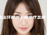 凉山牙根尖上瘤治疗怎样矫正有效果