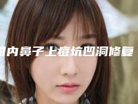 国内鼻子上痘坑凹洞修复医院排名：鼻子上痘坑凹洞修复医院前50名单专个精选