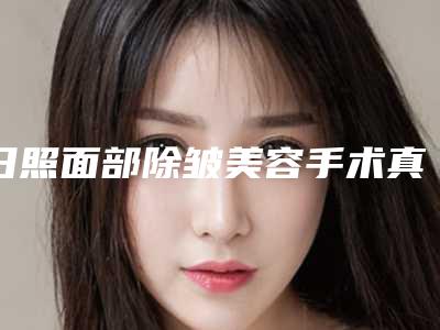 日照面部除皱美容手术真的有害吗