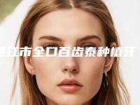 湛江市全口百齿泰种植牙医院在榜名单综合实力前十名全新出炉（湛江市全口百齿泰种植牙口腔医院是不错的选择）
