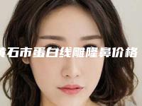 黄石市蛋白线雕隆鼻价格(价目)表看看不会错(蛋白线雕隆鼻均价为：4884元）
